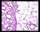 streptococcus mutans micrograph
